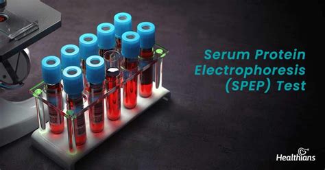 spe blood test bottle|spep serum protein location.